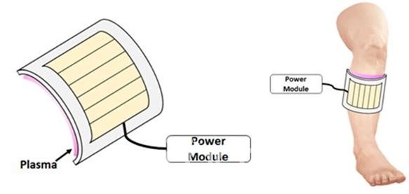 유연저극 기반 광 플라즈마 시스템을 활용한 치료 개념도(자료제공 : 경기도)